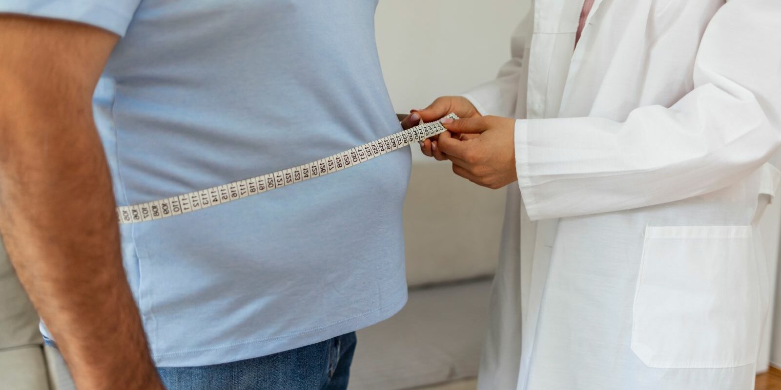Biliopancreatic limb length for Mini Gastric Bypass Biliopancreatic Limb Length